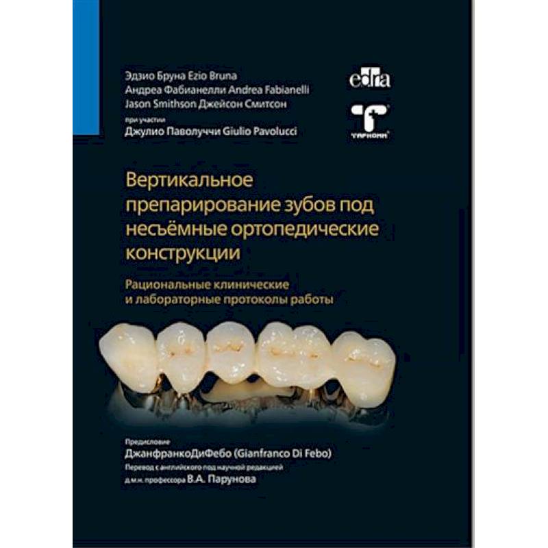 Вертикальное препарирование зубов под несъемные ортопедические конструкции