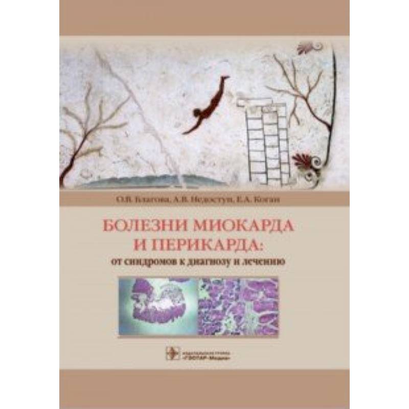 Болезни миокарда и перикарда. От синдромов к диагнозу и лечению Болезни миокарда и перикарда. От синдромов к диагнозу и лечению