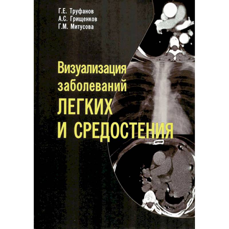 Визуализация заболеваний легких и средостения Визуализация заболеваний легких и средостения
