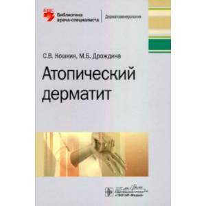 Атопический дерматит Атопический дерматит