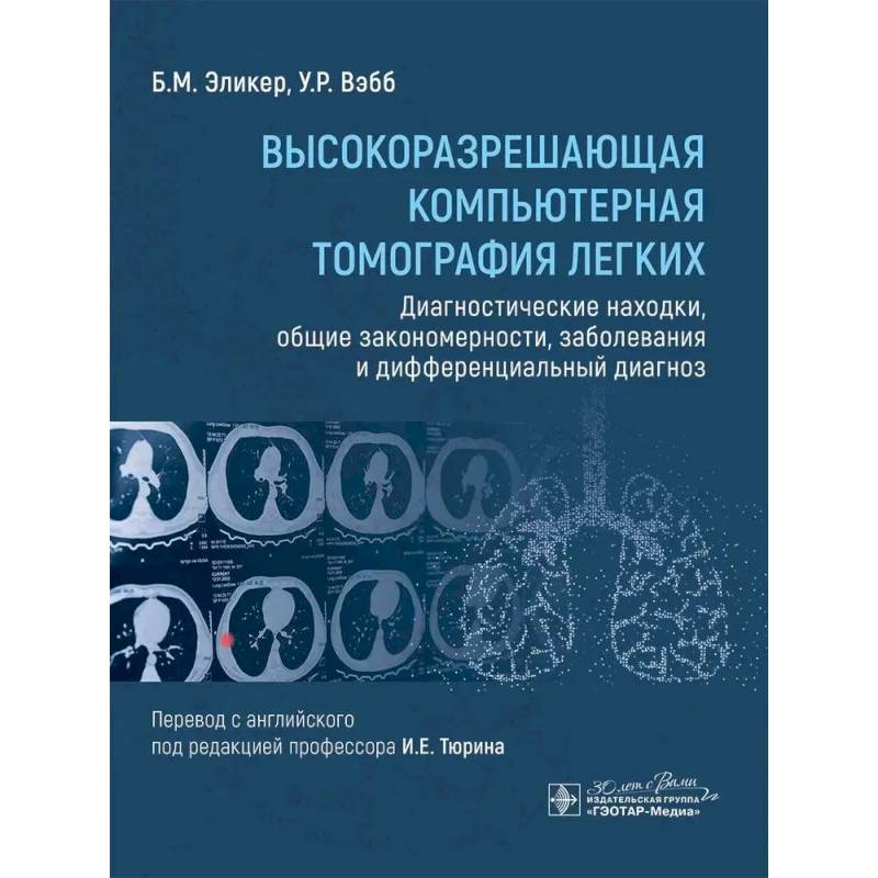 Высокоразрешающая компьютерная томография легких. Диагностические находки, общие закономерности, заболевания и дифференциальный диагноз
