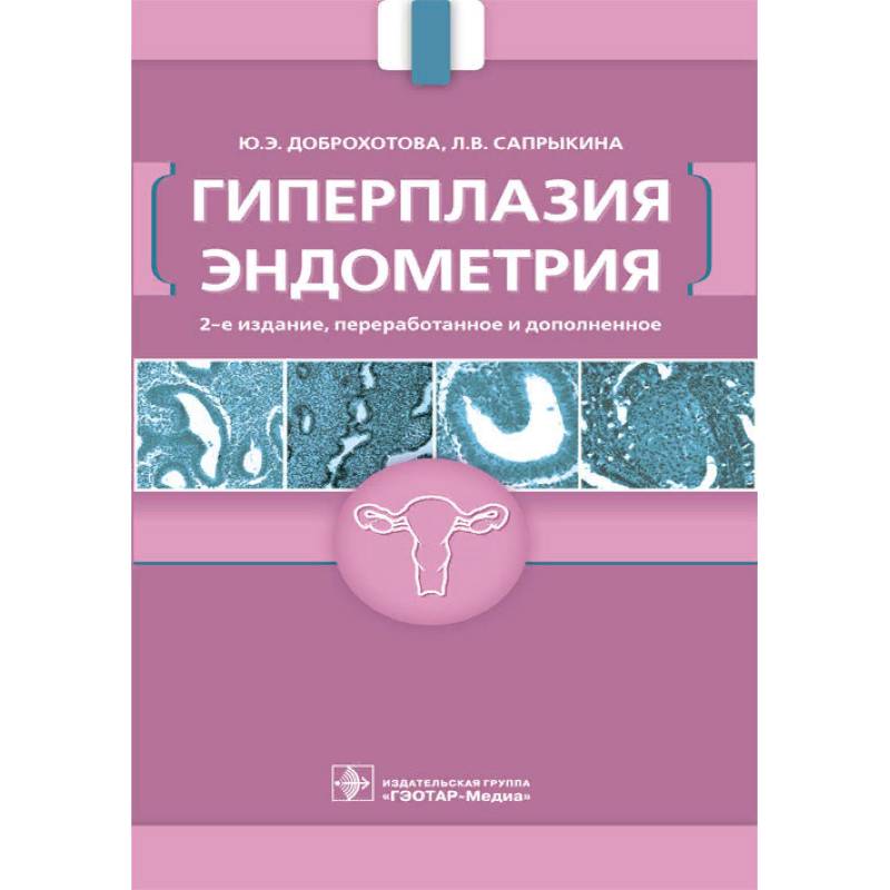 Гиперплазия эндометрия Гиперплазия эндометрия