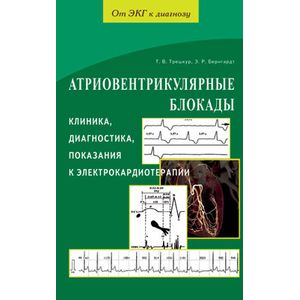 Атриовентрикулярнные блокады. Клиника,диагностика,показания к электрокардиотерапии