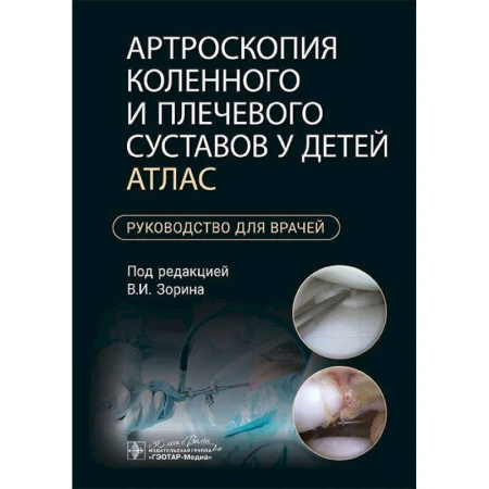 Хирургия. Ортопедия, книга Артроскопия коленного и плечевого суставов у детей. Атлас : руководство для врачей купить по скидке