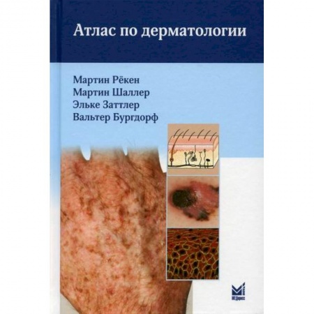 Кожные и венерические болезни, книга Атлас по дерматологии купить по скидке