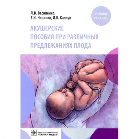 Акушерство и гинекология, книга Акушерские пособия при различных предлежаниях плода купить по скидке