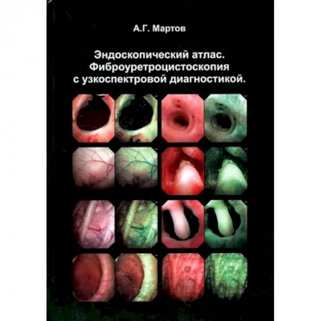 Урология, книга Эндоскопический атлас. Фиброуретроцистоскопия с узкоспектровой диагностикой купить по скидке