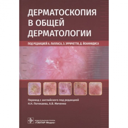 Кожные и венерические болезни, книга Дерматоскопия в общей дерматологии купить по скидке