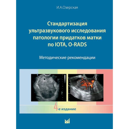 УЗИ. ЭКГ. Томография. Рентген, книга Стандартизация ультразвукового исследования патологии придатков матки по IOTA, O-RADS. Методические рекомендации. 4-е издание купить по скидке