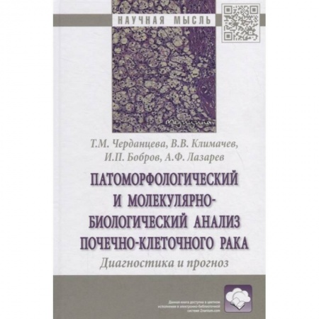 Онкология, книга Патоморфологический и молекулярно-биологический анализ почечно-клеточного рака. Диагностика и прогноз. Монография купить по скидке