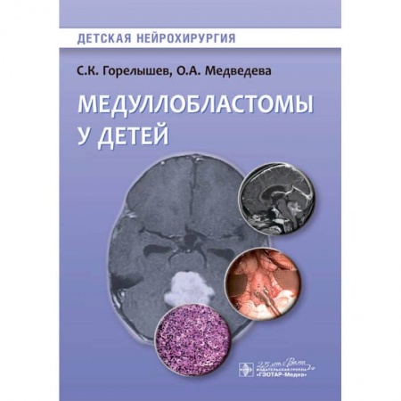 Хирургия. Ортопедия, книга Медуллобластомы у детей купить по скидке