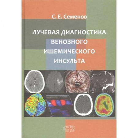 Кардиология, книга Лучевая диагностика венозного ишемического инсульта купить по скидке