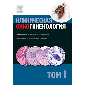 Клиническая онкогинекология. В 3 томах. Том 1 Клиническая онкогинекология. В 3 томах. Том 1