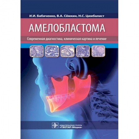 Стоматология, книга Амелобластома. Современная диагностика, клиническая картина и лечение купить по скидке
