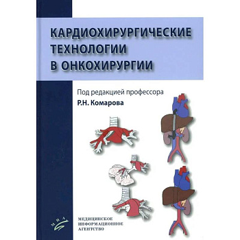 Кардиохирургические технологии в онкохирургии