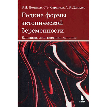 Редкие формы эктопической беременности. Клиника, диагностика, лечение Редкие формы эктопической беременности. Клиника, диагностика, лечение